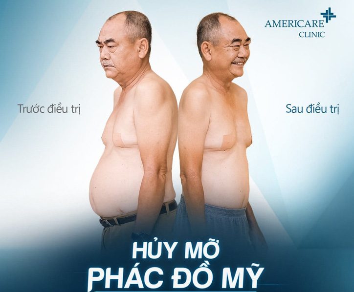 Chiêu trò quảng cáo của Americare Clinic và sự thật về công nghệ siêu giảm  béo - TIN TỨC SỨC KHOẺ 247