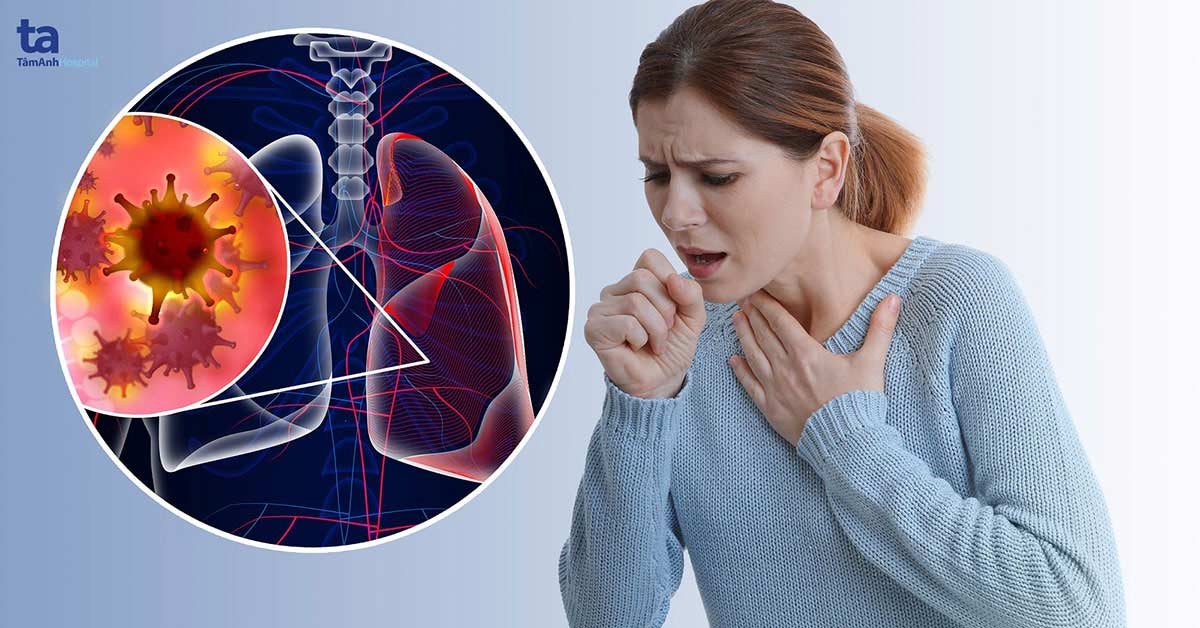 Ung thư phổi – Không chỉ dành cho người hút thuốc